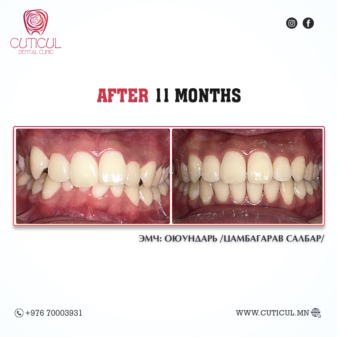Result Image 3